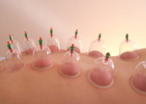 cupping dos profil