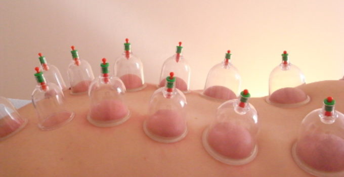 cupping dos profil