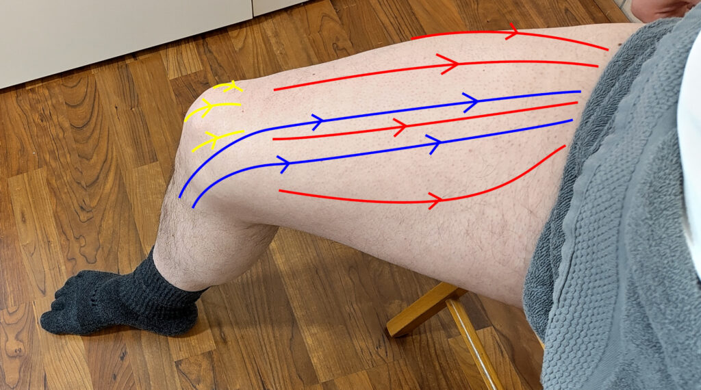 Trajectoires des pressions glissées pour un auto-drainage lymphatique du genou